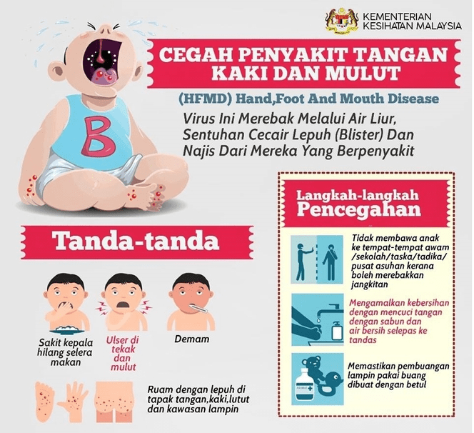 Pencegahan dan Tanda Awal Penyakit Tangan Kaki Dan Mulut HFMD